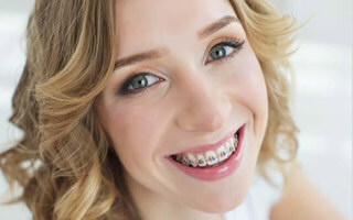 smiling patient with braces and straight teeth