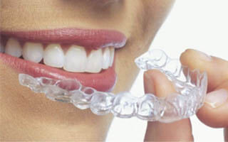 young woman using Invisalign clear aligner with nice smile