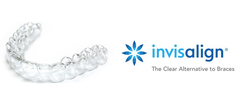 Invisalign clear aligner to straighten teeth with orthodontist